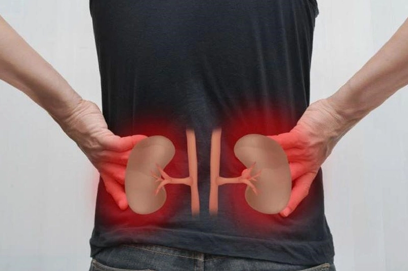 Bệnh lý về thận có thể khiến người bệnh bị đau ở hông trái