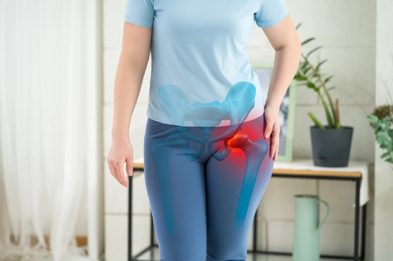 Viêm bao hoạt dịch khớp háng có thể gây đau ở vùng hông