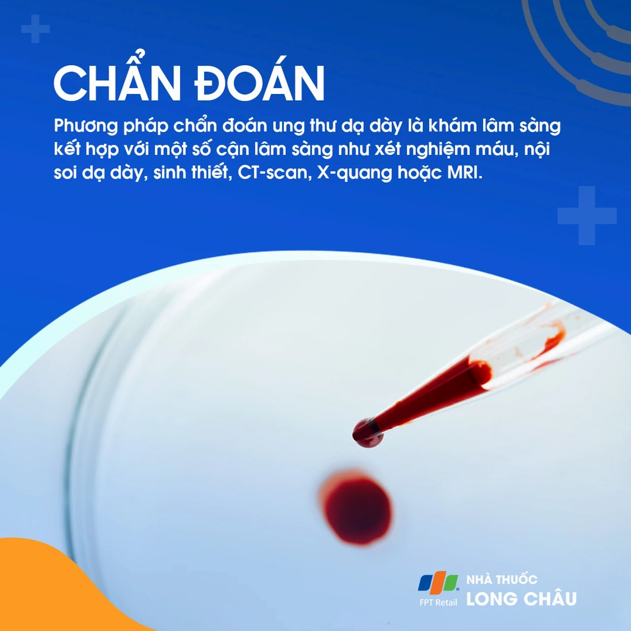 Chế độ dinh dưỡng lành mạnh với nhiều rau xanh giúp phòng ngừa ung thư dạ dày